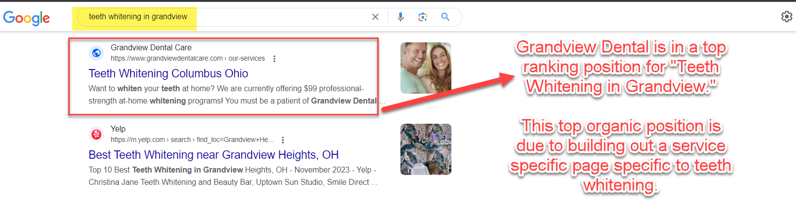 Example of The Media Captain's dental client ranking well for the query, “Teeth Whitening in Grandview.”