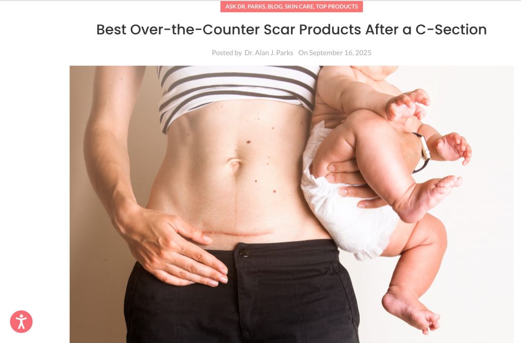  Gemini said A blog post titled "Best Over-the-Counter Scar Products After a C-Section" by Dr. Alan J. Parks, featuring an image of a woman holding a baby and showing a C-section scar on her lower abdomen.
